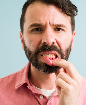 man pointing to inflamed gums