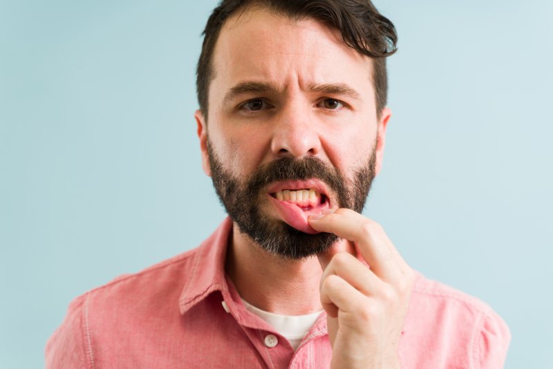 A young man suffering from gingivitis, a form of gum disease